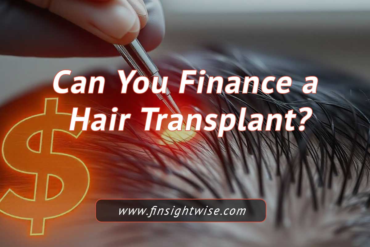 You are currently viewing Can You Finance a Hair Transplant? Explore Your Options